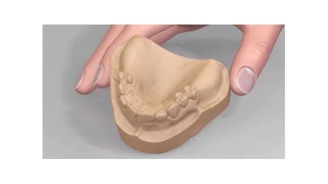 Gipsevi tip 4