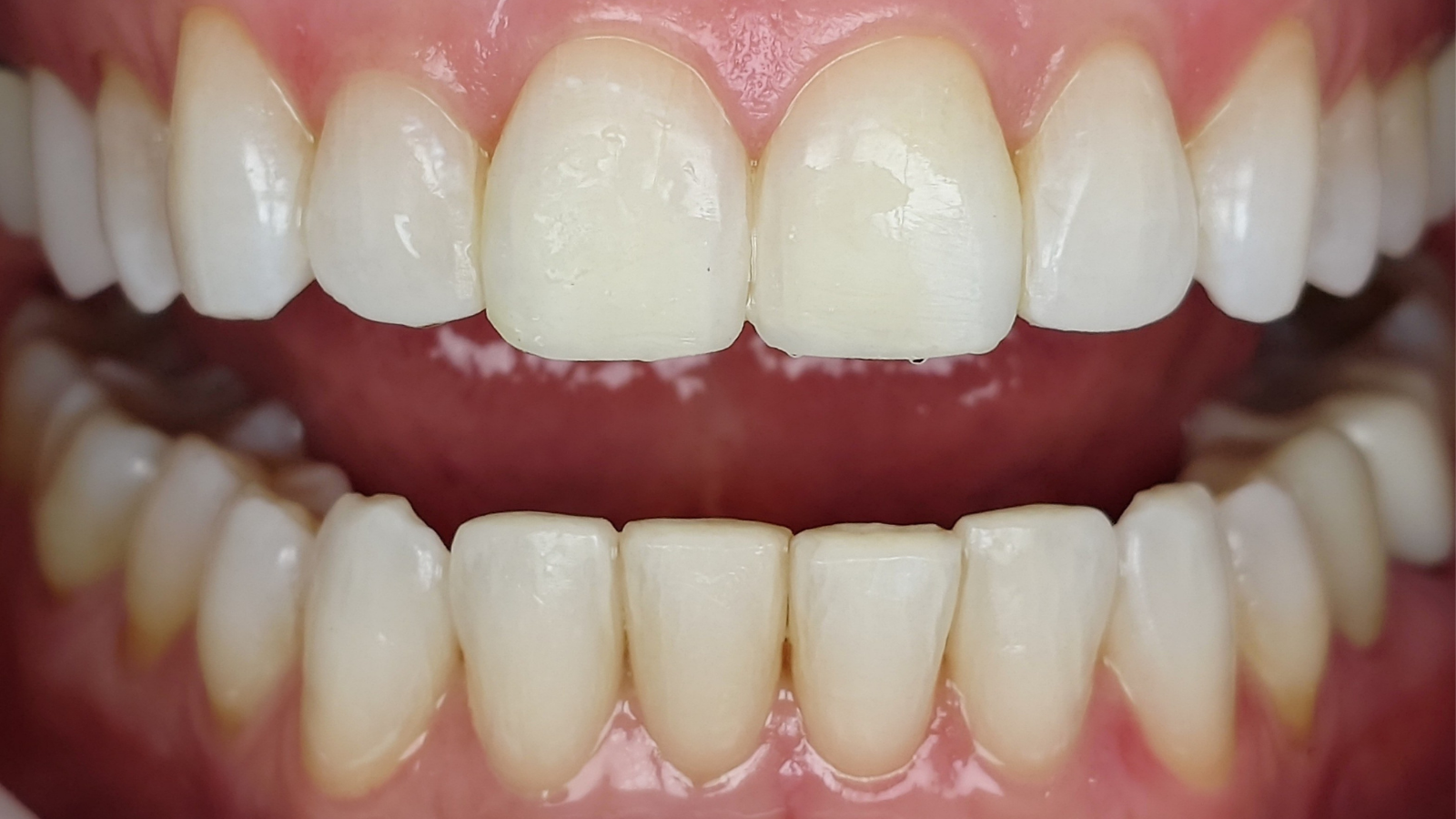 Click and hold the green slider. Move from side to side to reveal the before-and-after pictures.